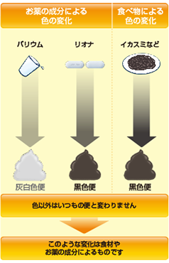 22+ 黒い 便 画像 16 リオナの吸収・排泄│リオナ.jp│鳥居薬品 医療関係者向け情報